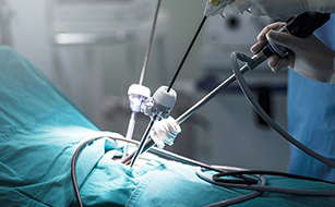 Laparoscopic Surgery